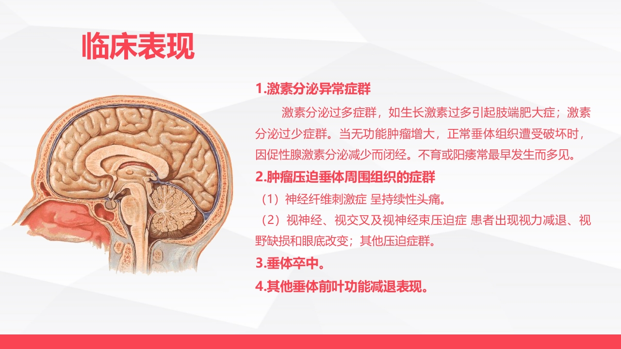 垂体瘤病人护理