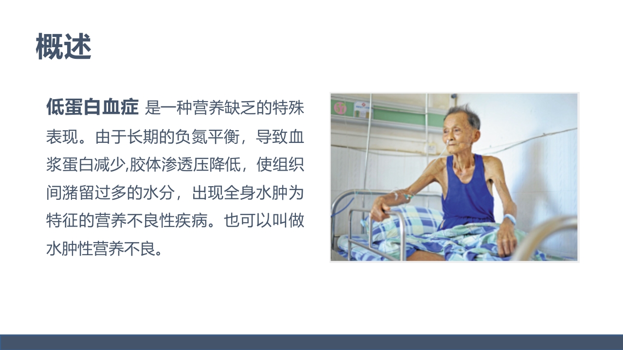 低蛋白血症的护理