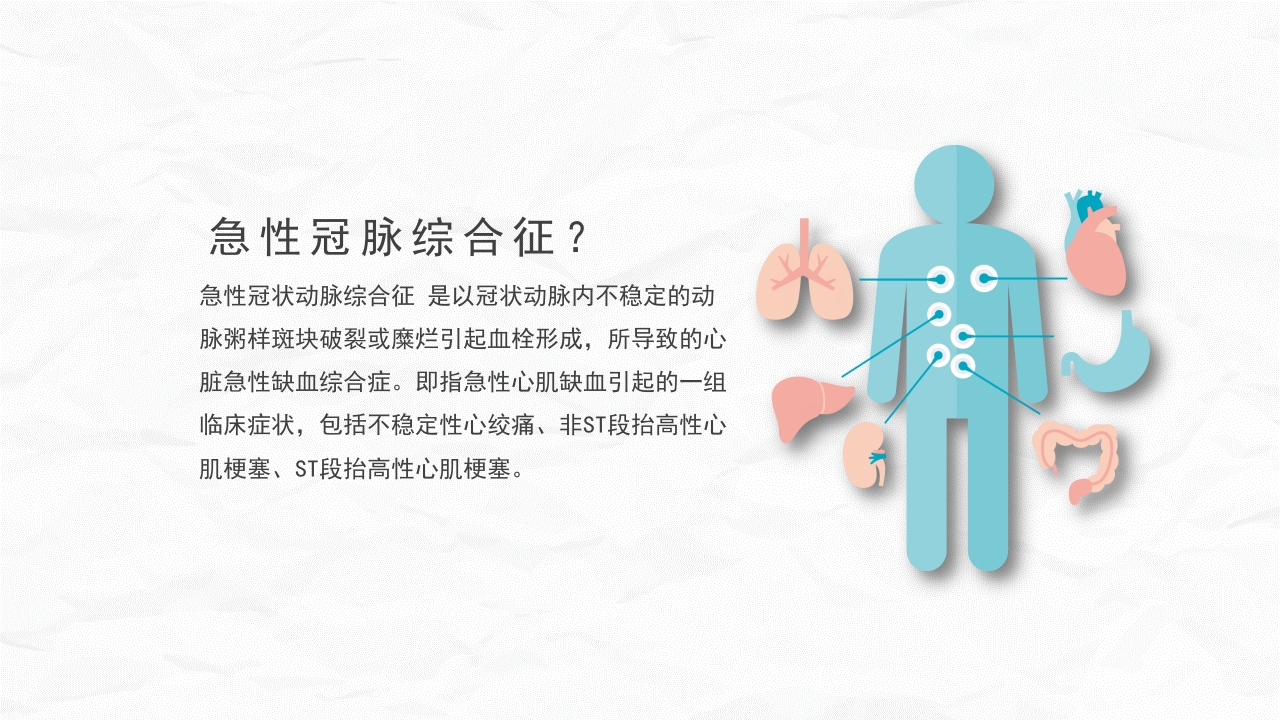 急性冠脉综合症护理查房(1)