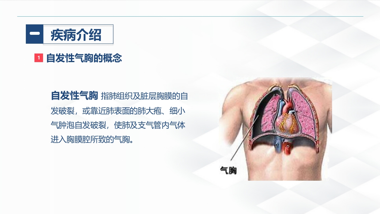 结核病科-结核性胸膜炎患者自发性气胸的护理查房