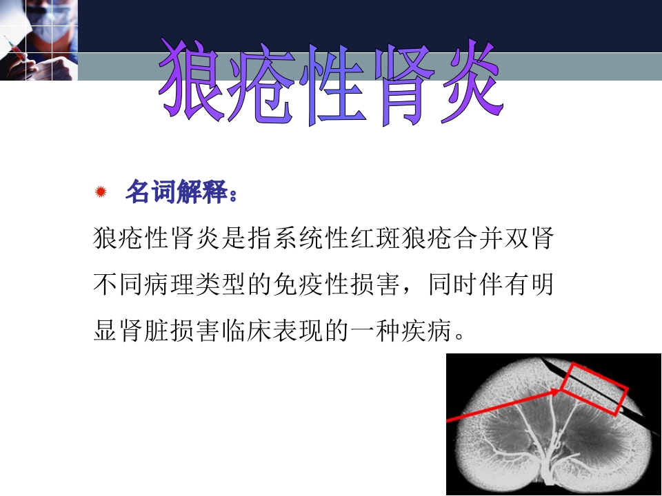 狼疮性肾炎的护理常规ppt