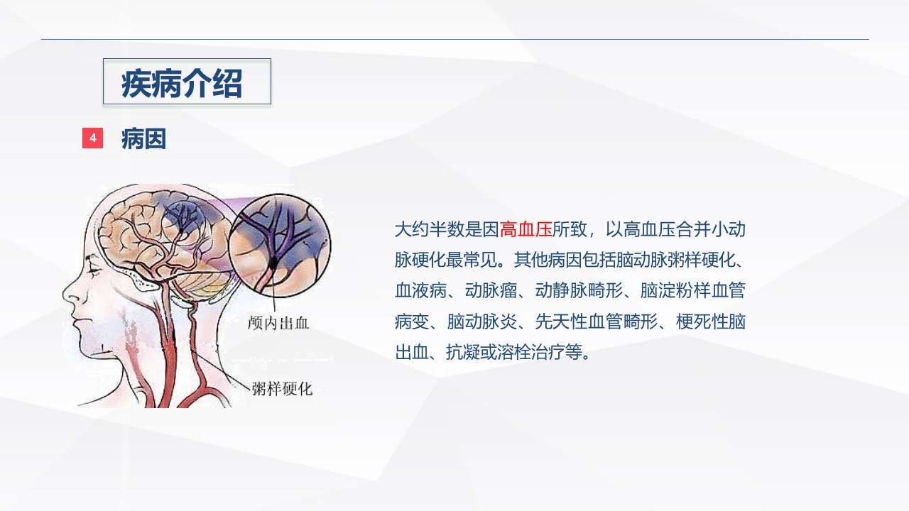 脑出血疾病介绍+术后护理