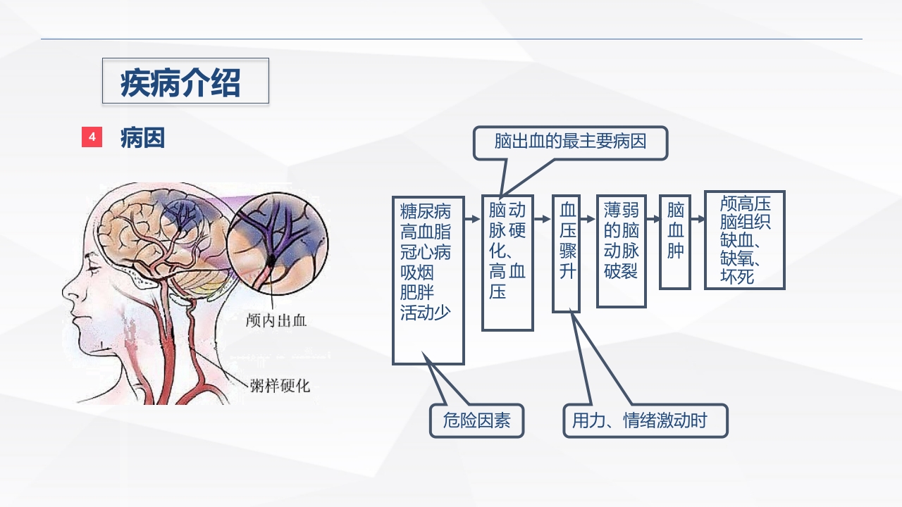 脑出血疾病介绍+术后护理