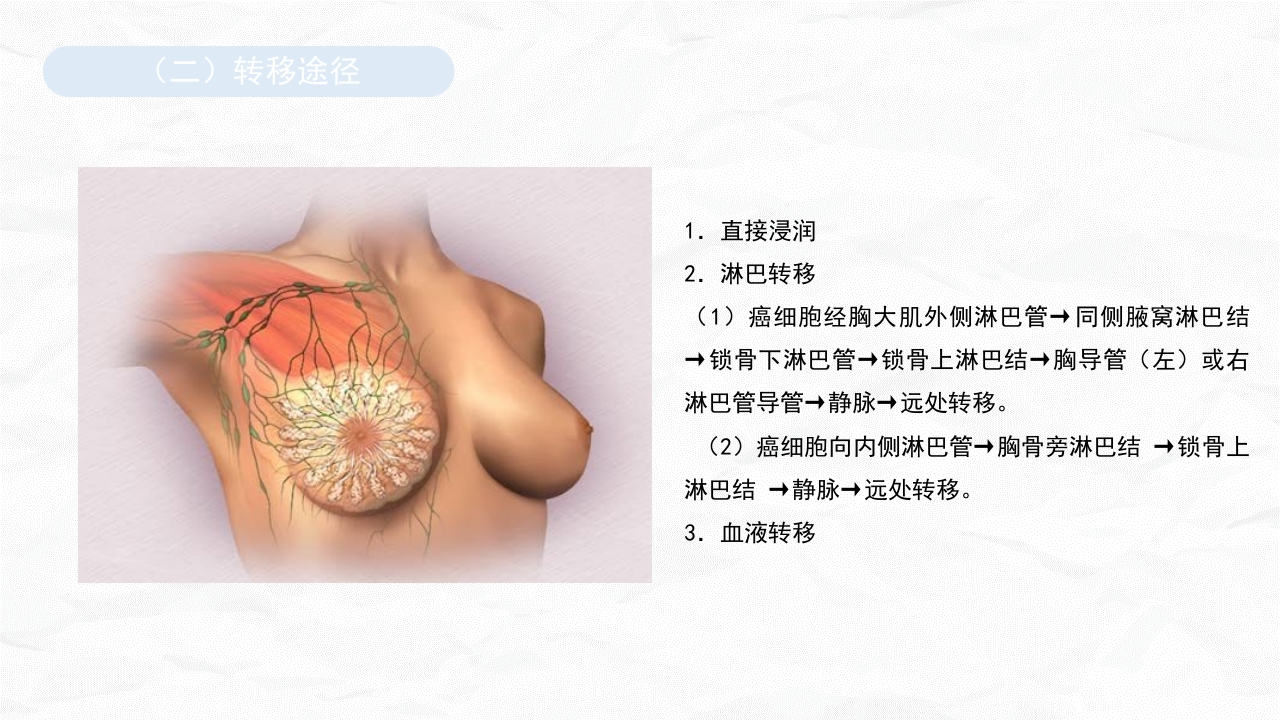 乳腺癌护理查房