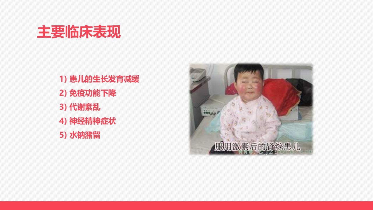 肾病患儿服用激素后的临床表现及护理