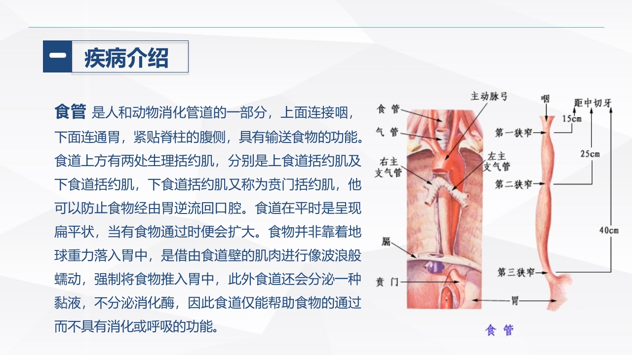 食管癌的护理(1)