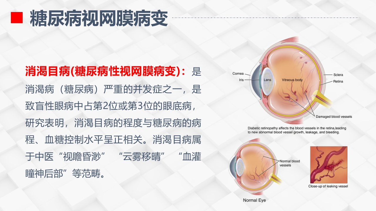 糖尿病视网膜病变患者护理查房