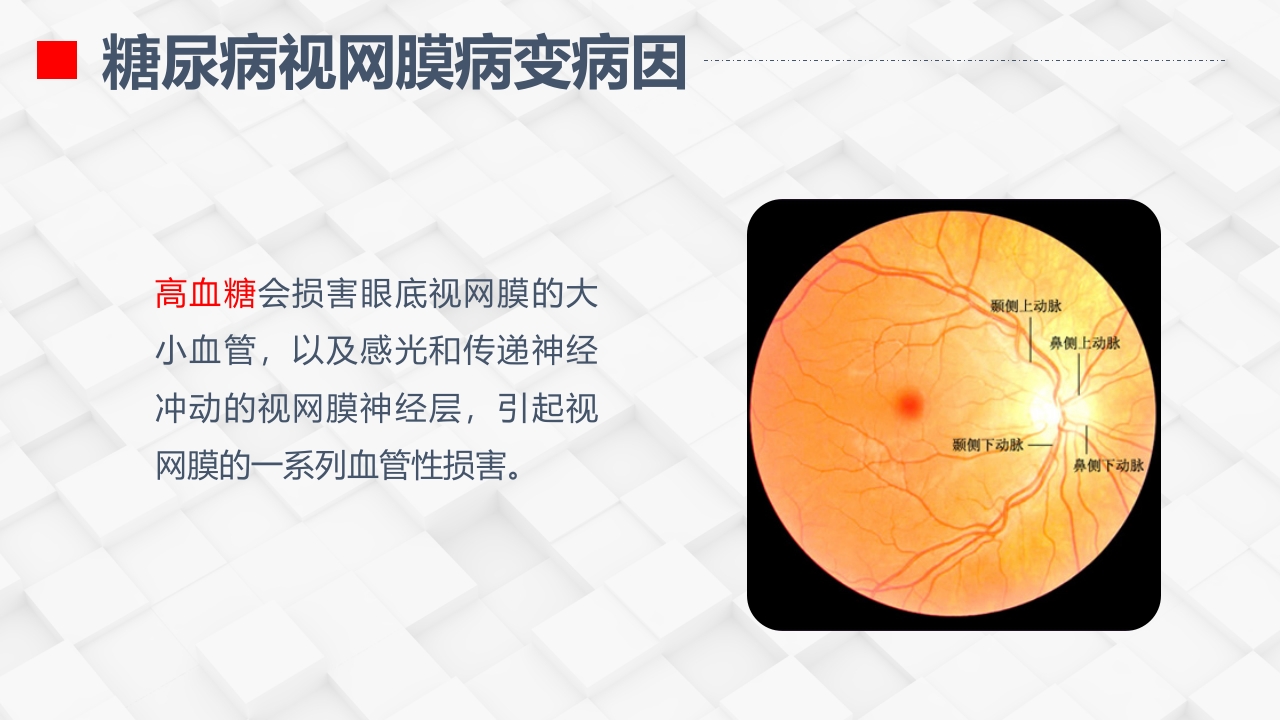 糖尿病视网膜病变患者护理查房