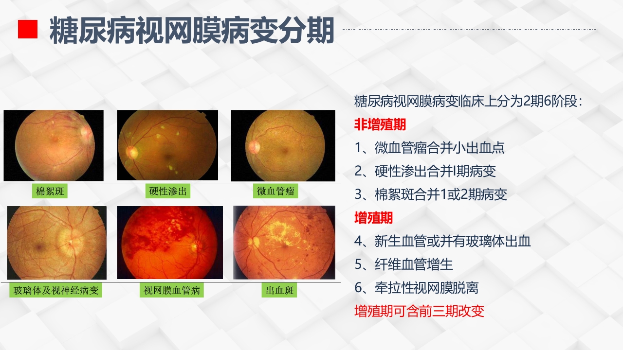 糖尿病视网膜病变患者护理查房