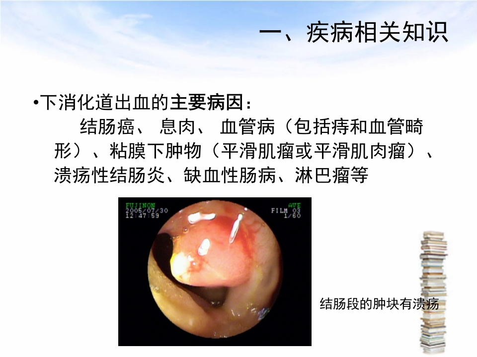 下消化道出血伴失血性休克护理查房