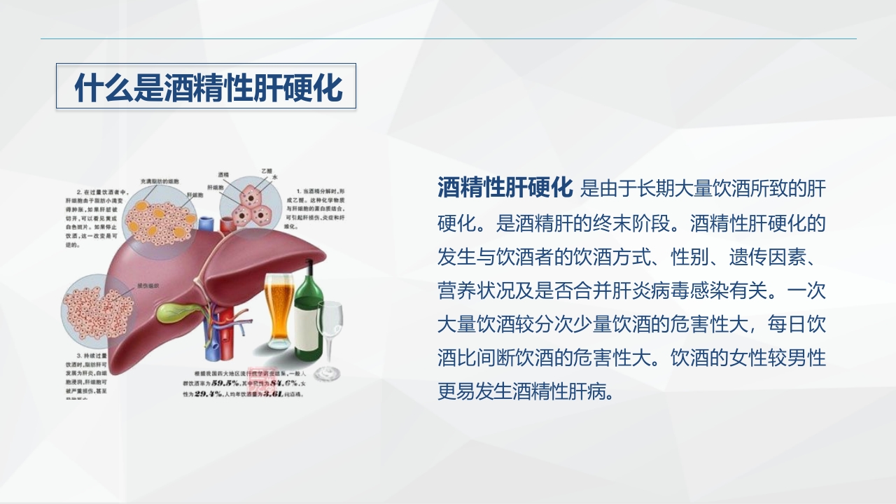 消化内科-酒精性肝硬化护理教学查房