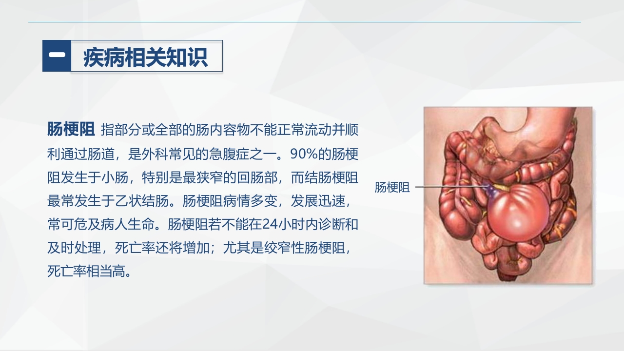消化内科-肠梗阻护理查房2