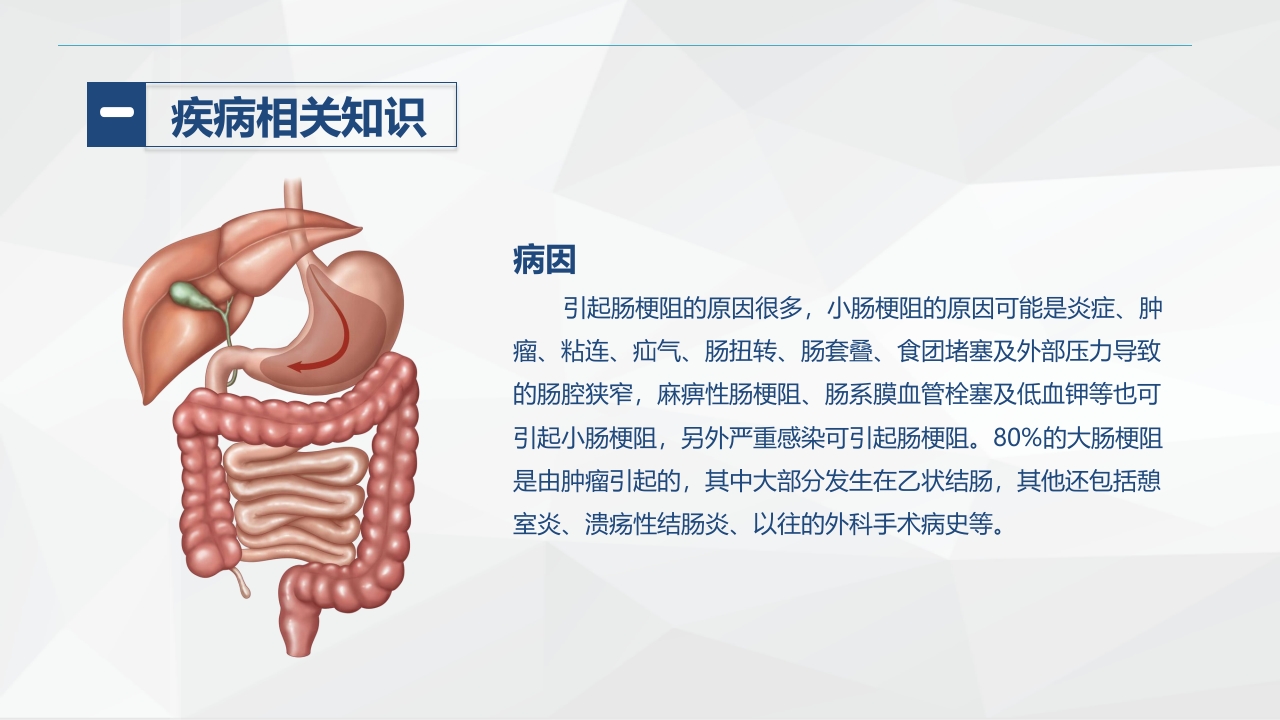 消化内科-肠梗阻护理查房2