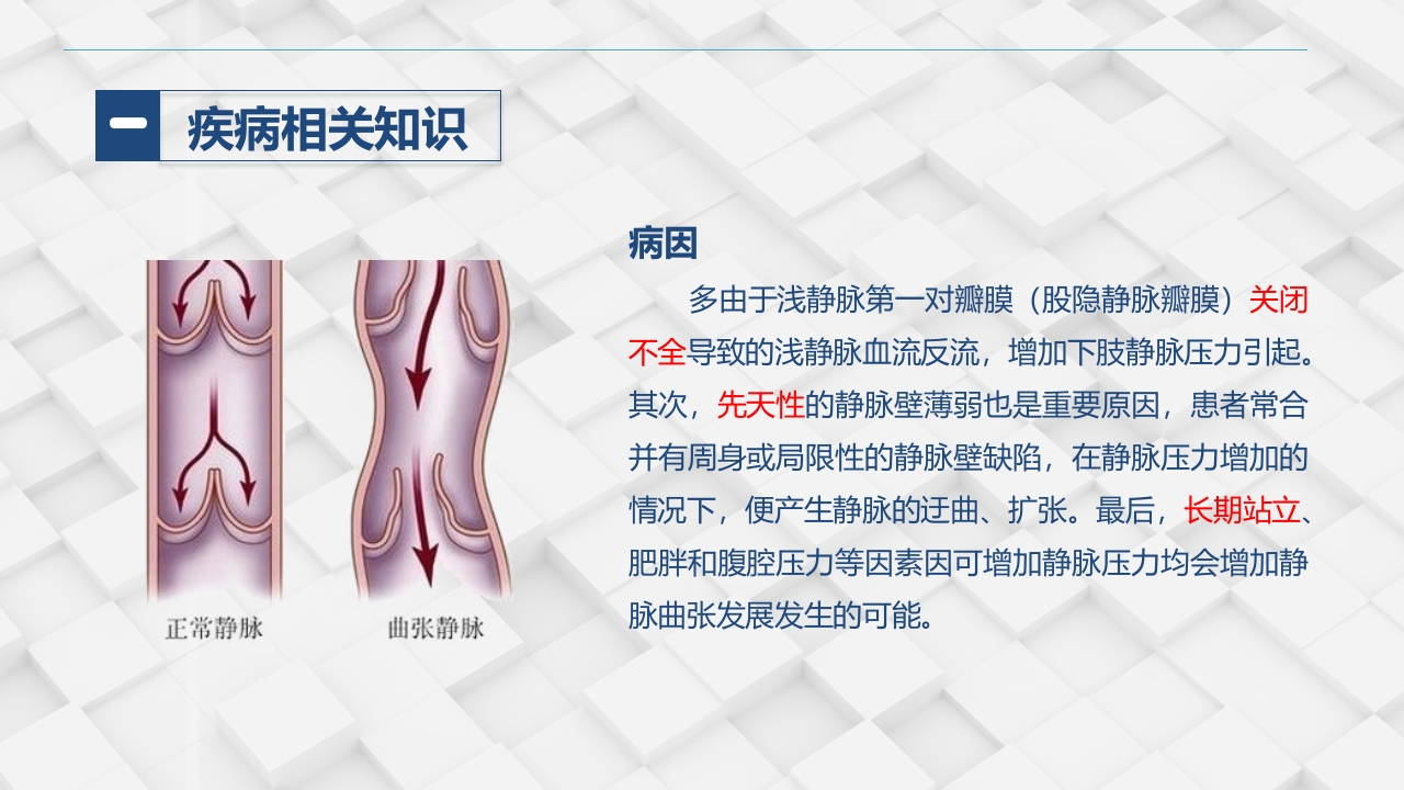 血管外科-下肢静脉曲张的护理查房