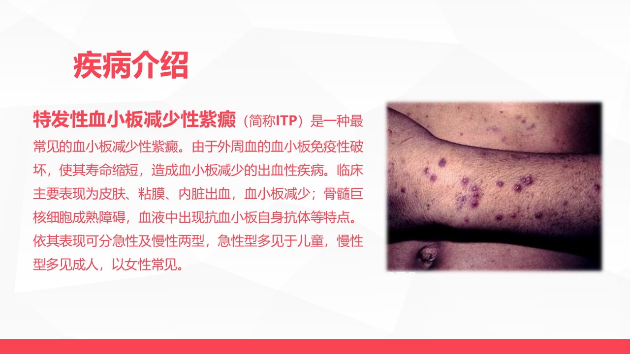 血液科-特发性血小板减少性紫癜病人的护理