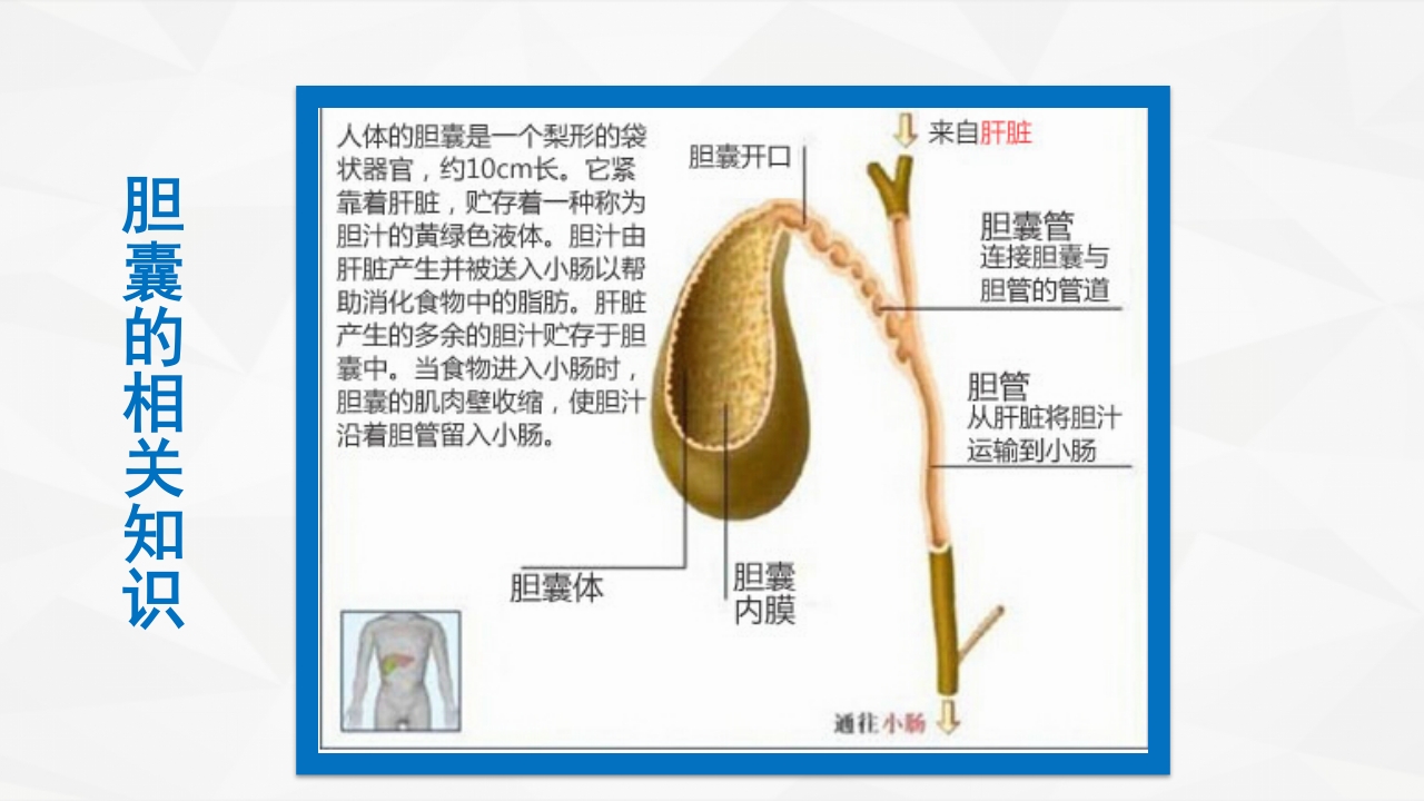 一例急性胆囊炎的护理查房