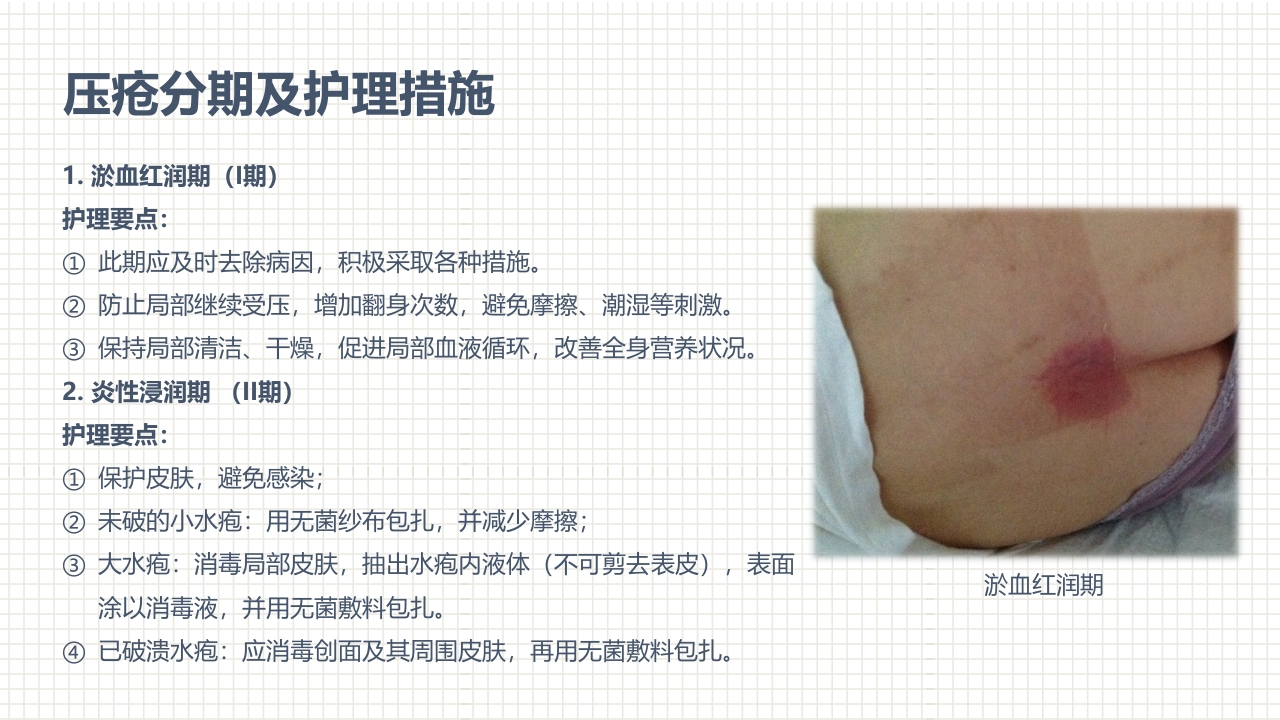 肿瘤科护理小讲课：第四周