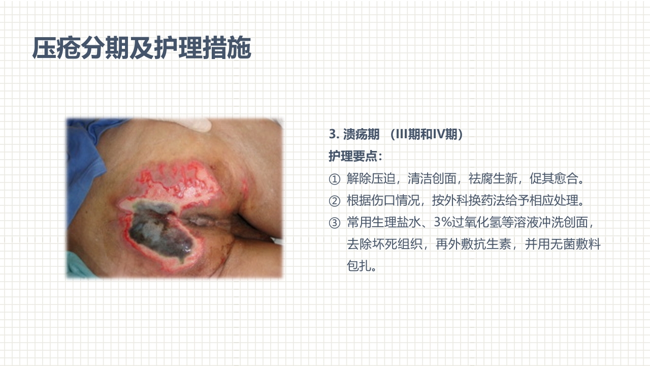 肿瘤科护理小讲课：第四周