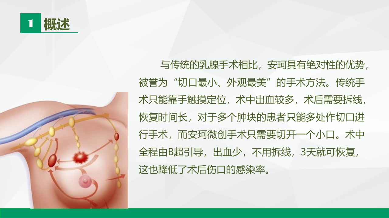 安珂乳腺旋切系统的临床应用