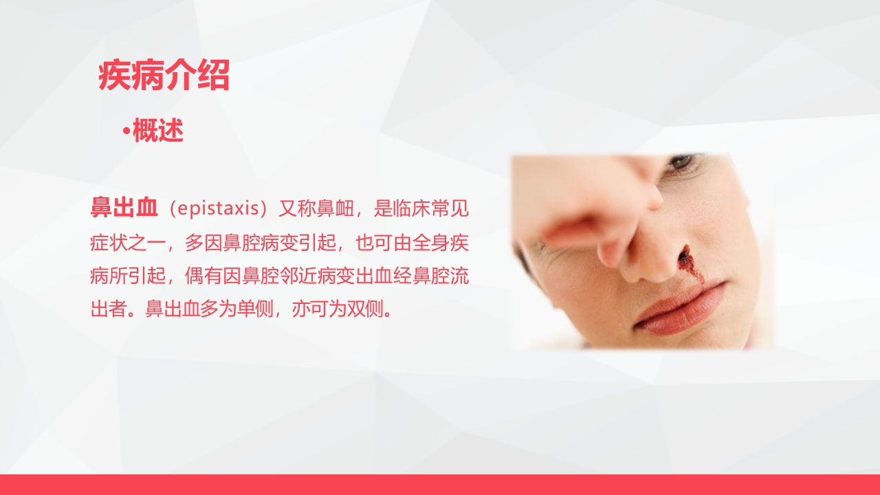 鼻出血的业务学习