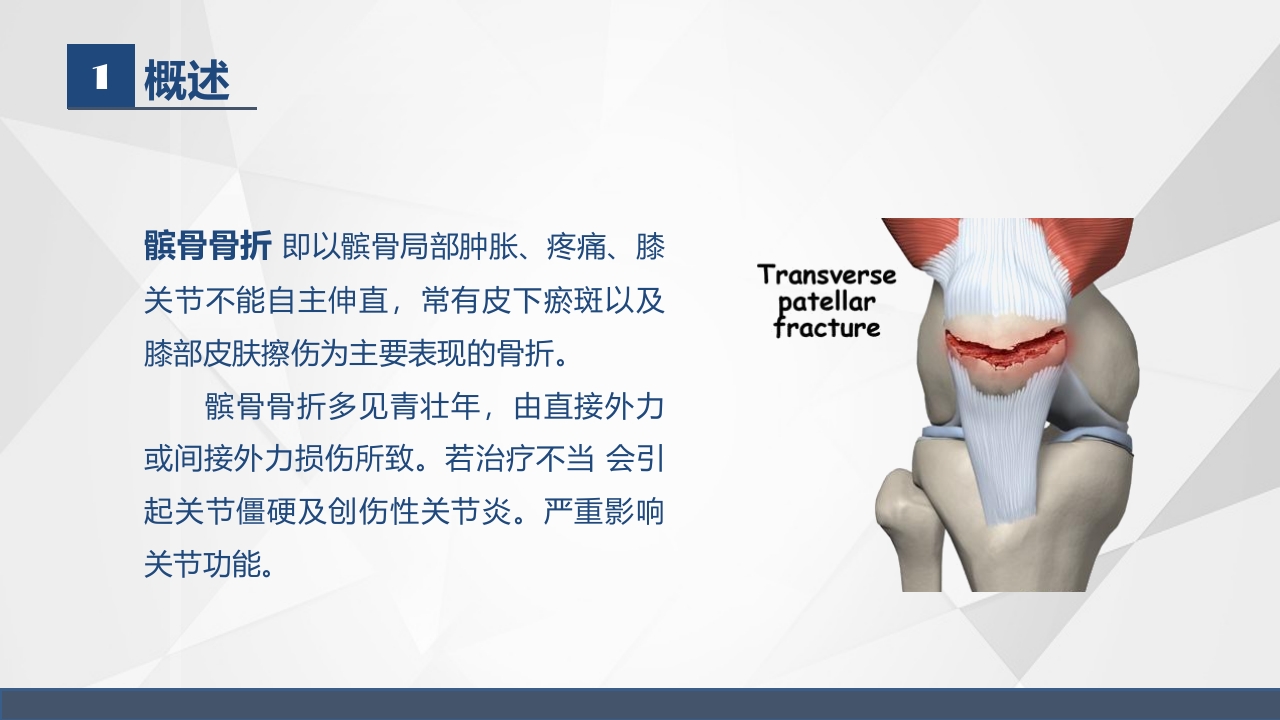 髌骨骨折的护理