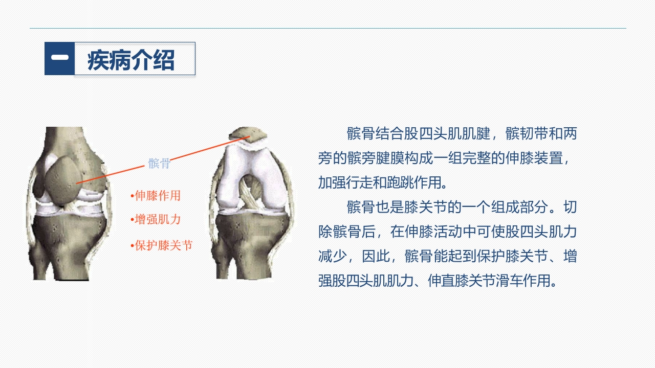 髌骨骨折的护理查房(1)