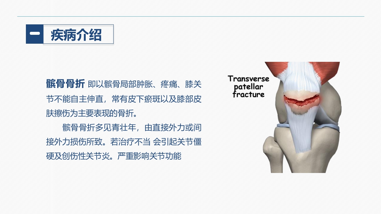 髌骨骨折的护理查房(1)