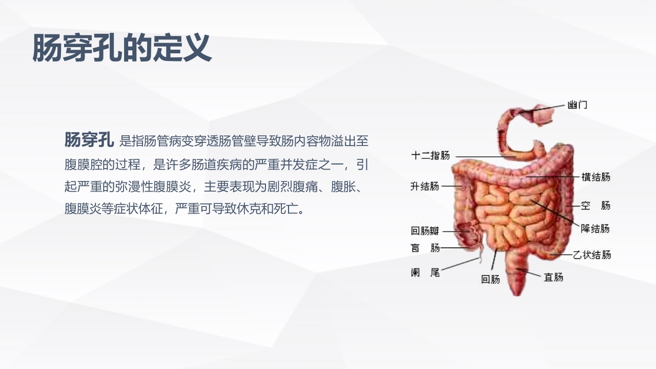 肠穿孔的护理学习