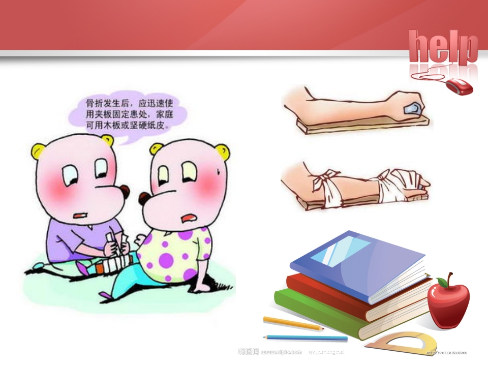 常见骨折的现场急救固定