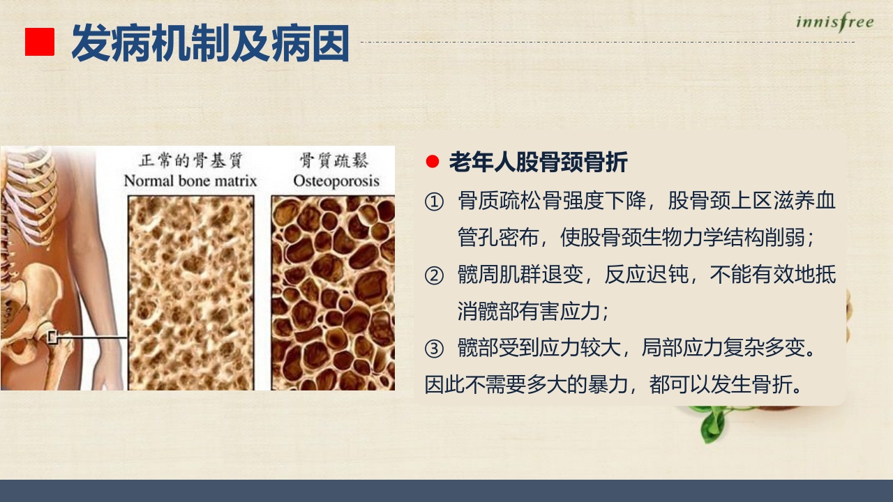 股骨颈骨折患者的护理查房