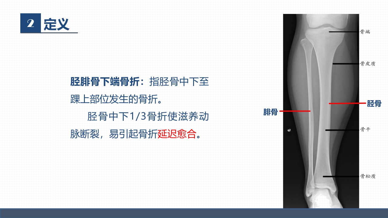 骨科胫腓骨骨折教育查房