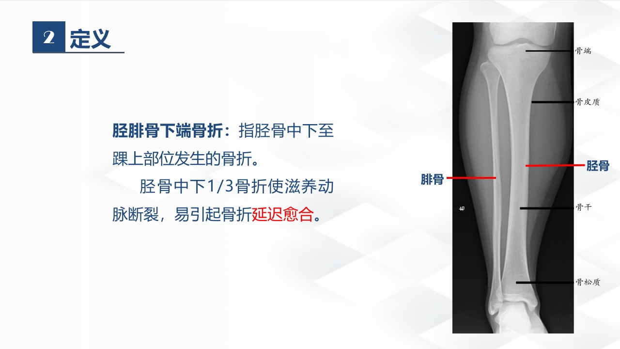 骨科-胫腓骨骨折教育查房