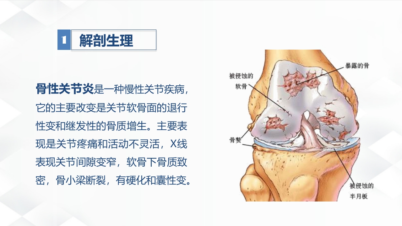 骨科-双膝骨性关节炎护理查房
