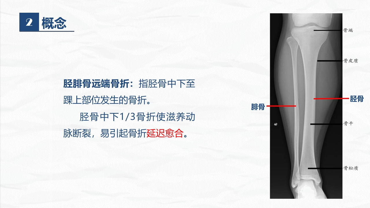 骨科-右胫腓骨远端骨折术合并骨盆骨折的护理查房