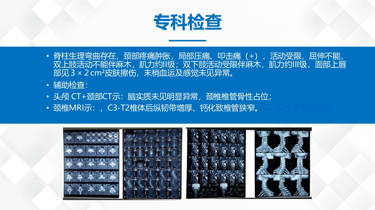 脊柱骨科-脊髓损伤护理查房