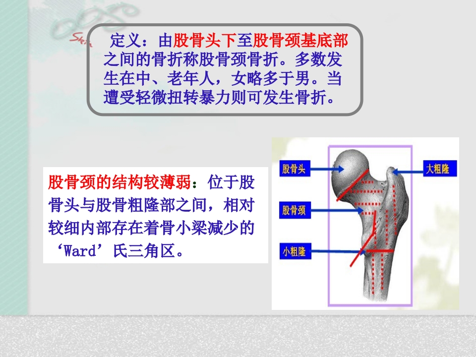 髋关节置换术后护理