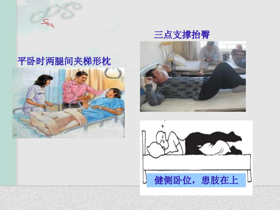 髋关节置换术后护理