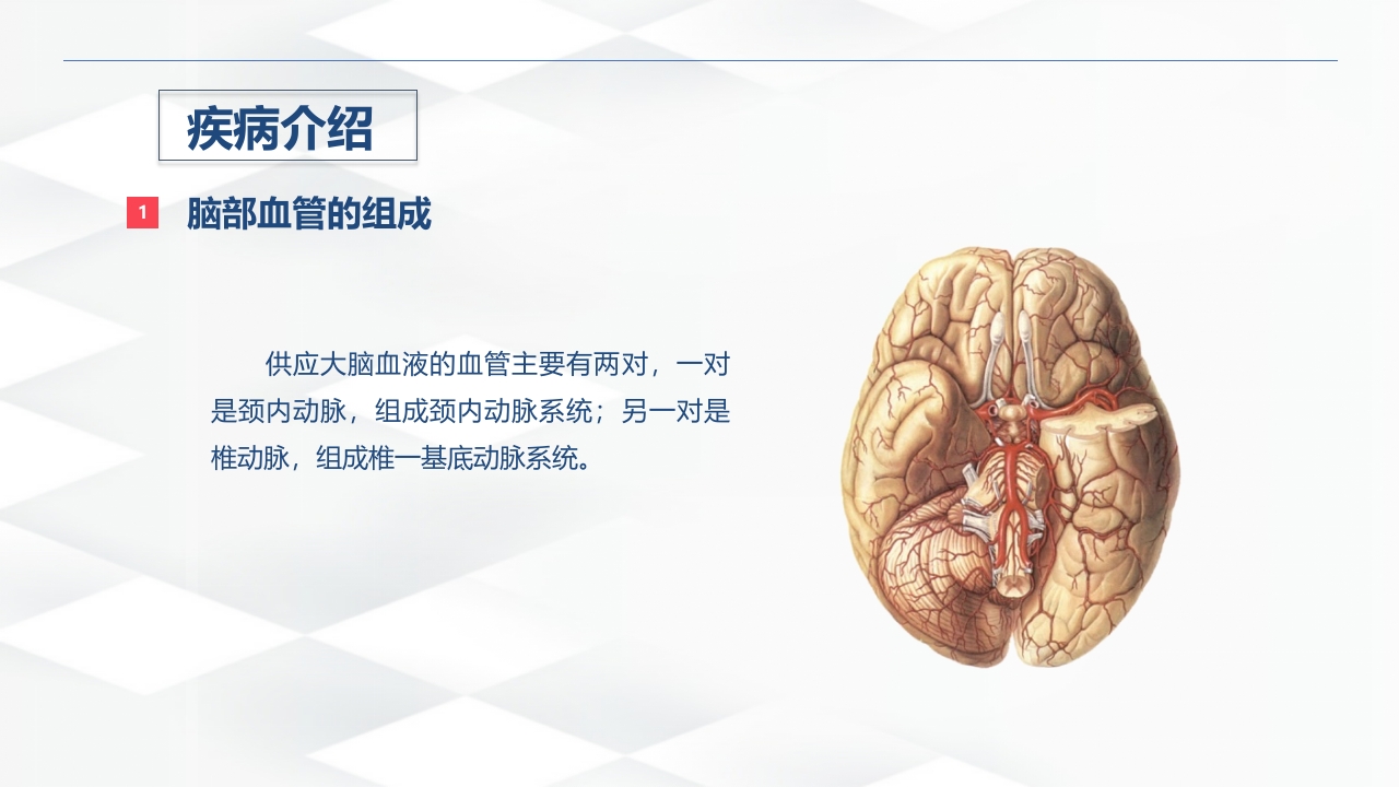 脑出血的术后护理