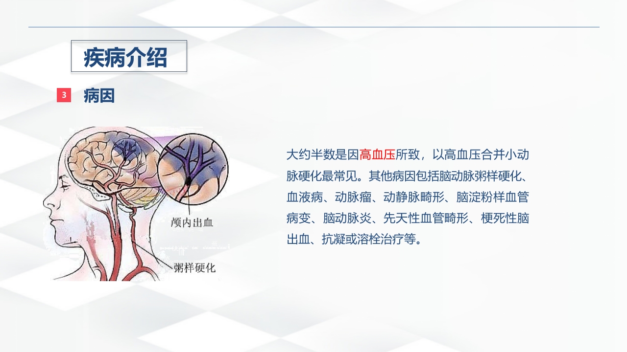 脑出血的术后护理