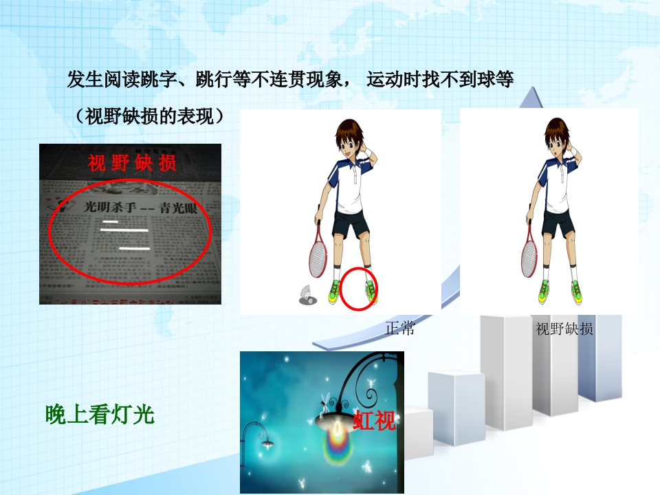 青光眼护理查房