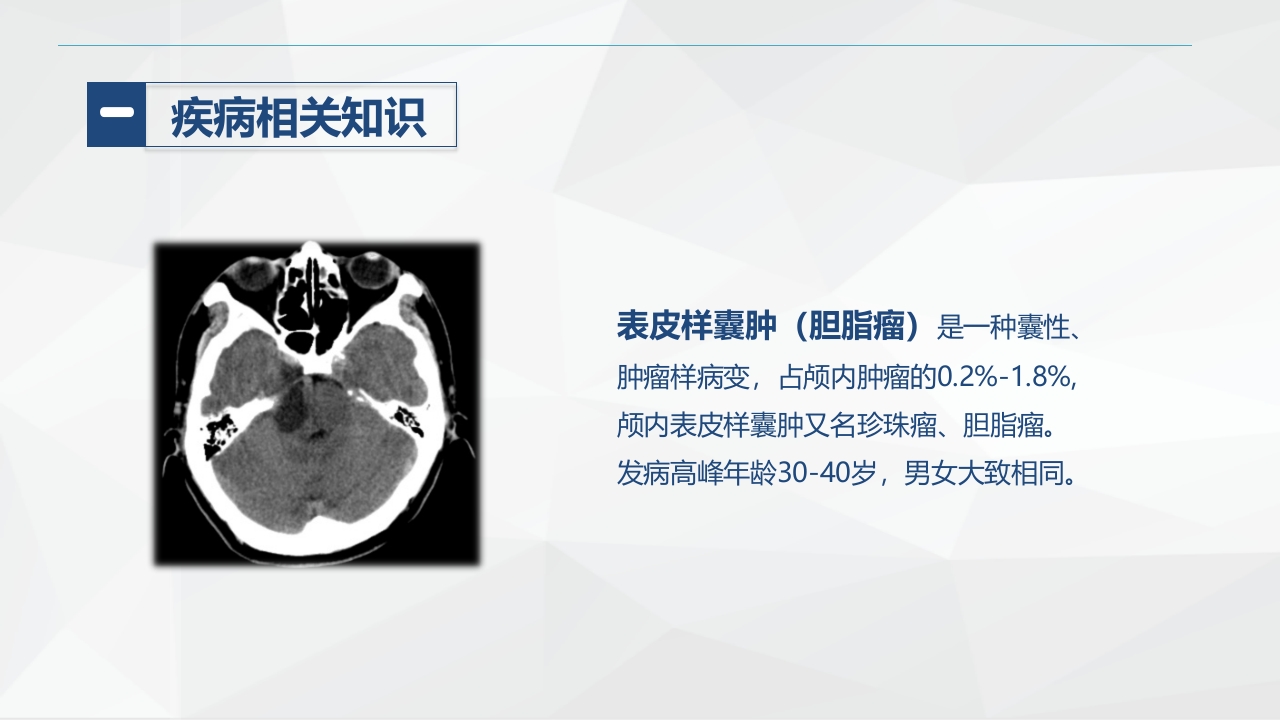 外科-颅内表皮样囊肿患者的护理查房