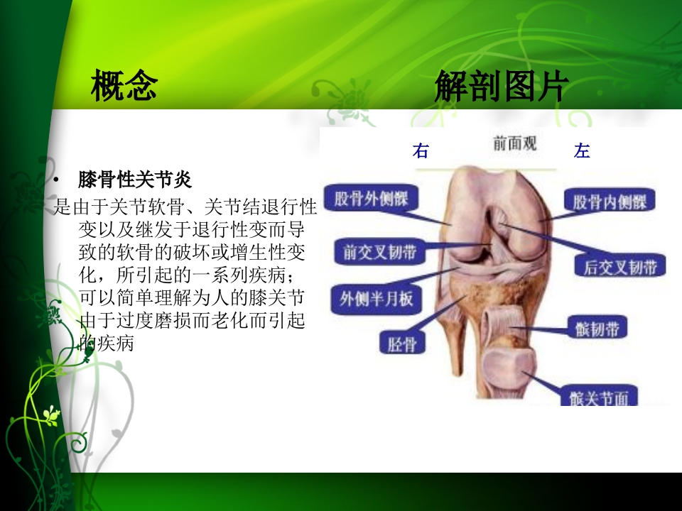 膝关节骨性关节炎护理查房
