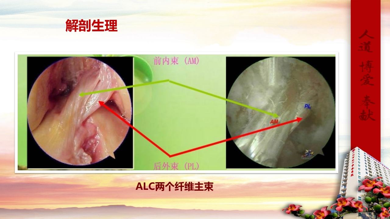 膝关节前十字韧带重建术的健康教育(1)