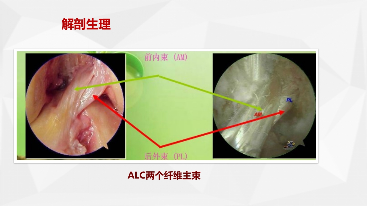 膝关节前十字韧带重建术的健康教育