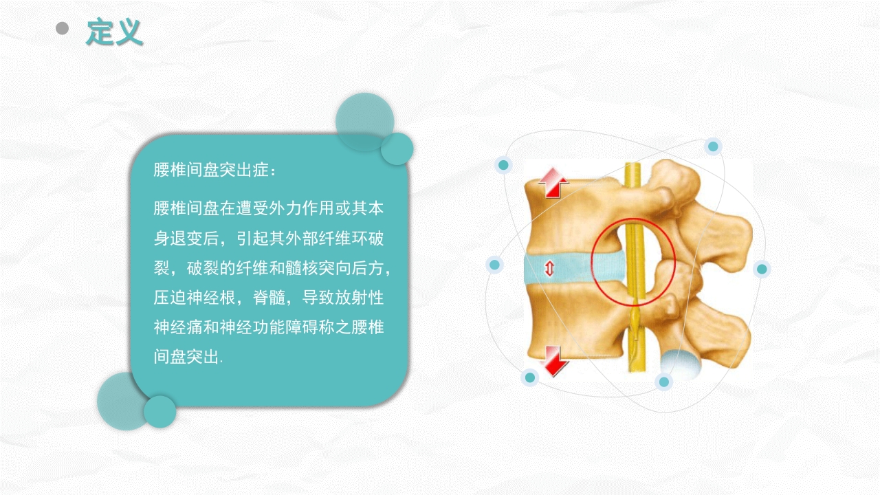 腰椎间盘突出症的康复护理