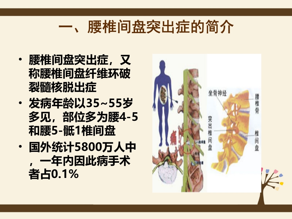 腰椎间盘突出症的预防和自我护理