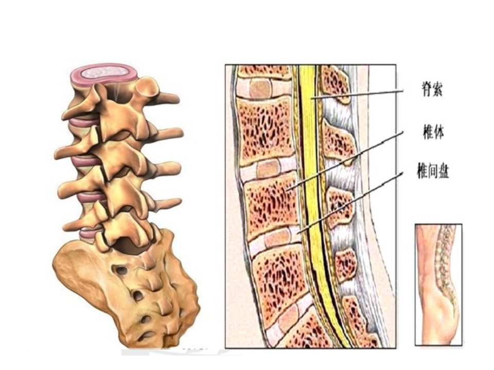 腰椎间盘突出症护理