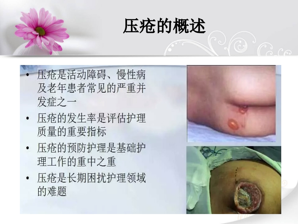 ICU培训班最终版危重患者压疮的评估与预防