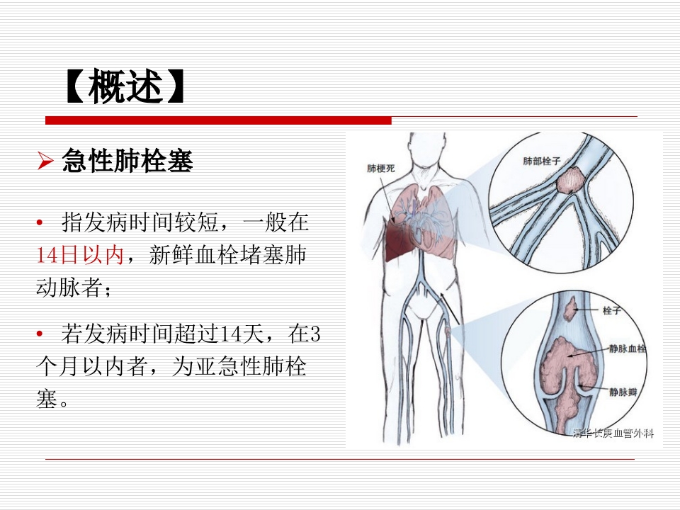 肺栓塞患者的监护