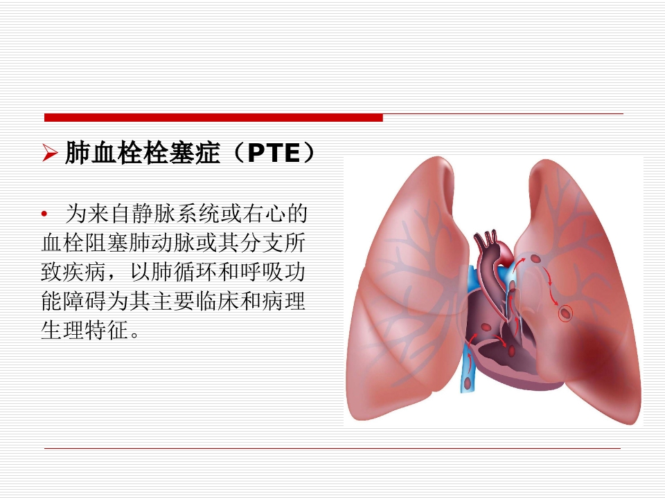 肺栓塞患者的监护